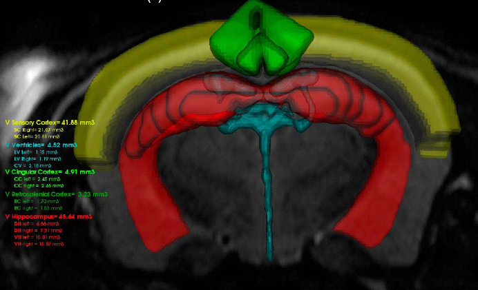 Méditation neurosciences qualité de vie au travail
