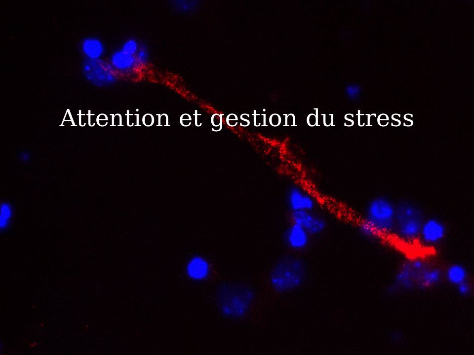 Management zen pour la gestion du stress